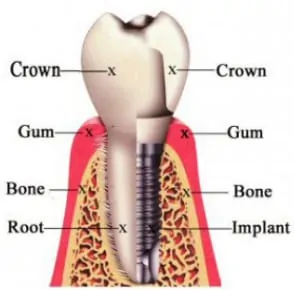 Dr. Jack T. Kayton